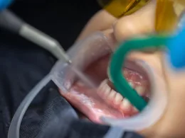 kwalifikacja do leczenia zębów w narkozie