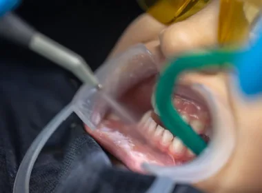 kwalifikacja do leczenia zębów w narkozie